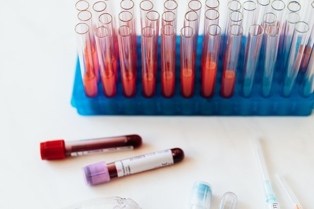 blood tests in a secure laboratory doing tests on covid infection and organ damage