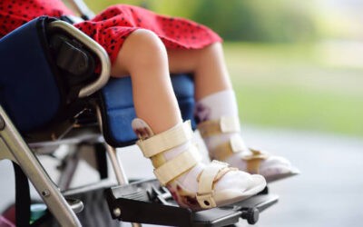 Latest Treatment Options for Cerebral Palsy